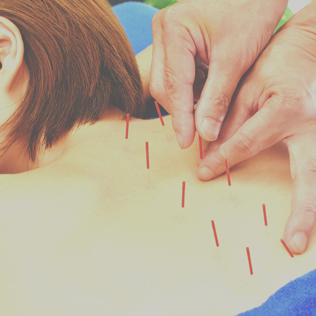 リラクゼーション鍼